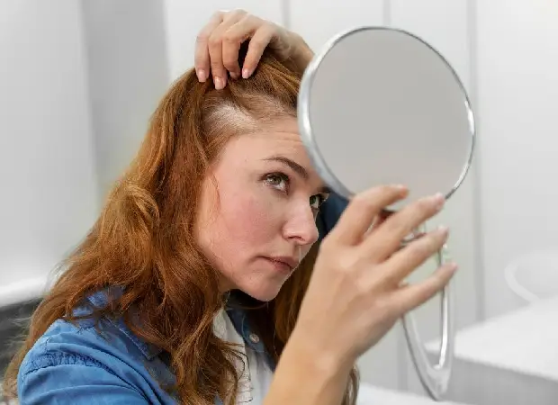 Hair Baldness In Female