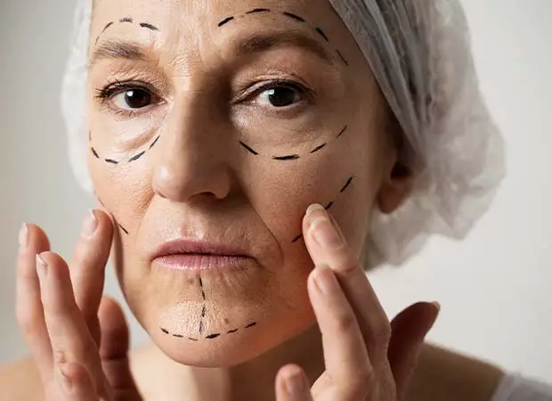 Fine Lines Treatment in Greater Kailash : Fine lines on face are primarily the early signs of ageing, and as surprising as it may sound, ageing starts around the age of 25.